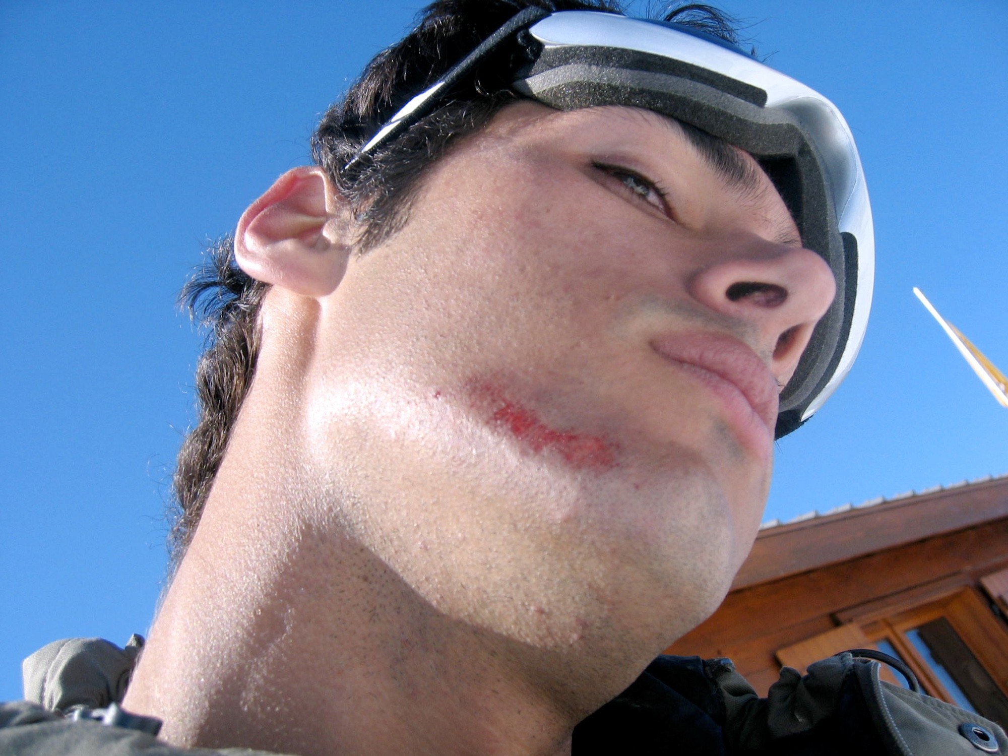 Snowboarding FIRST Injury! 