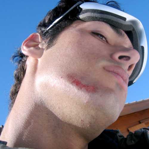 Snowboarding FIRST Injury! 